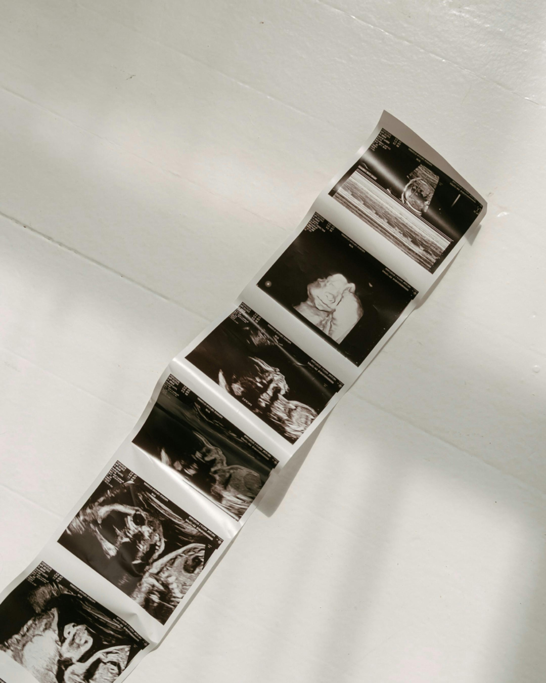 Tips for Improving Conception and Preparing for Pregnancy